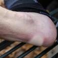 extra-Пластырь LIFESYSTEMS Blister Plasters